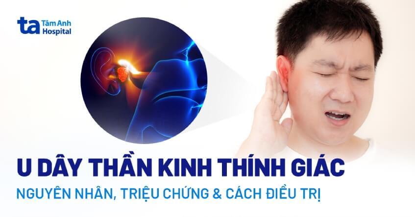 U dây thần kinh thính giác: Nguyên nhân, triệu chứng, điều trị