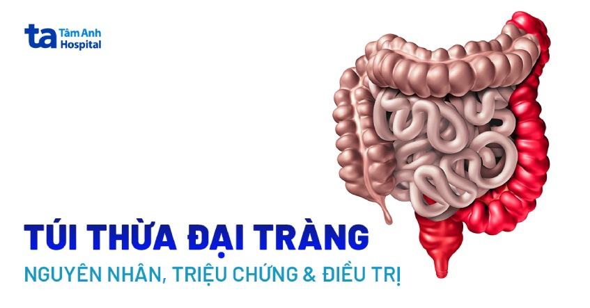 Mổ nội soi cắt đại tràng: Khi nào cần thực hiện?