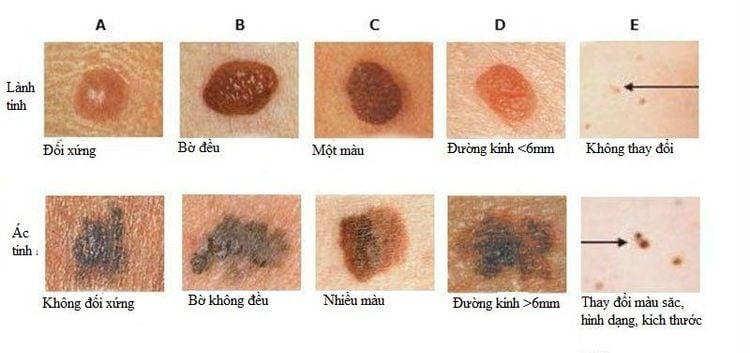 Ăn cà chua có tác dụng gì cho da?