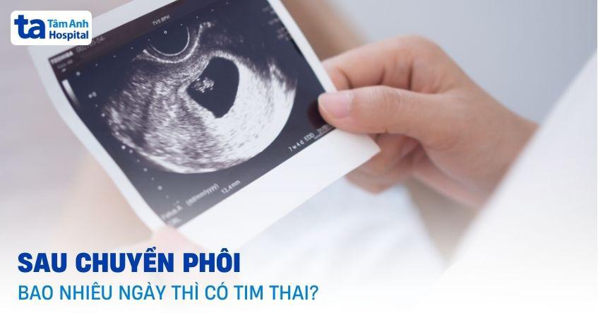 Sau chuyển phôi bao nhiêu ngày thì có tim thai? [GIẢI ĐÁP]