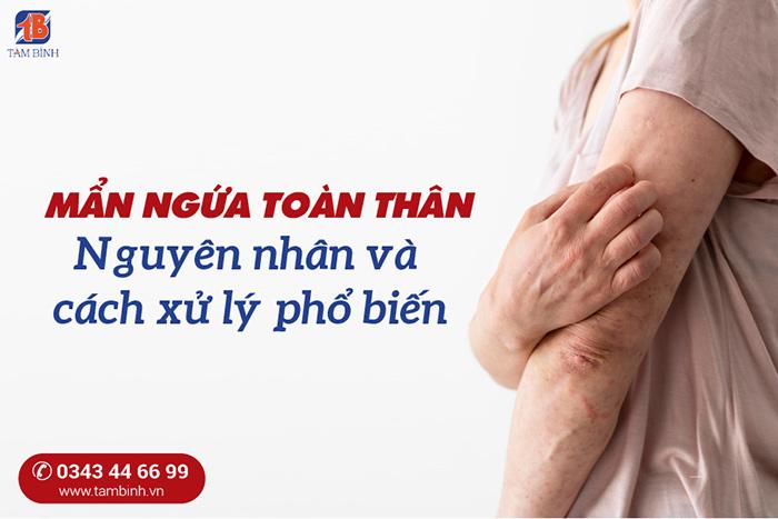 Mẩn ngứa toàn thân – Nguyên nhân và cách điều trị tốt nhất