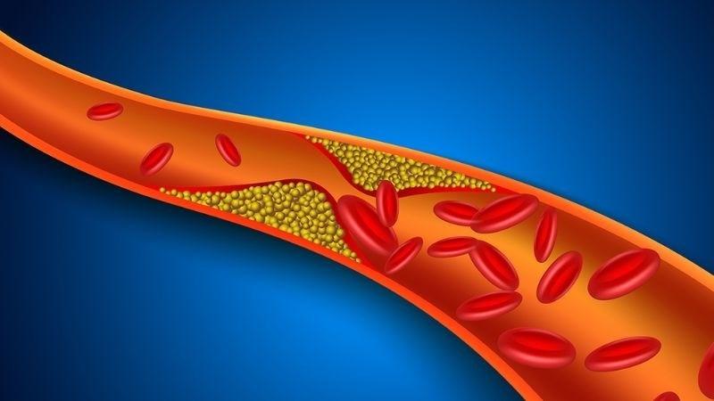 Vỏ chanh giúp ngăn ngừa tình trạng máu nhiễm mỡ