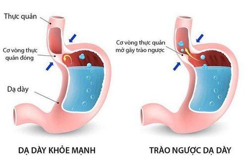 Tăng tiết nước bọt, do đâu?