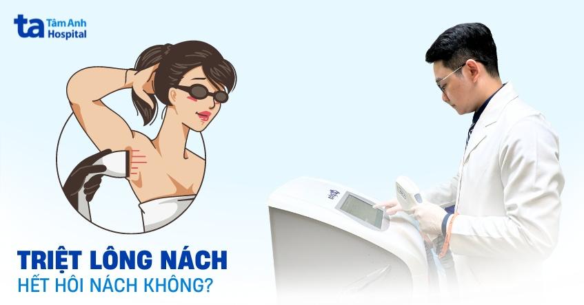 triệt lông nách có hết hôi nách không