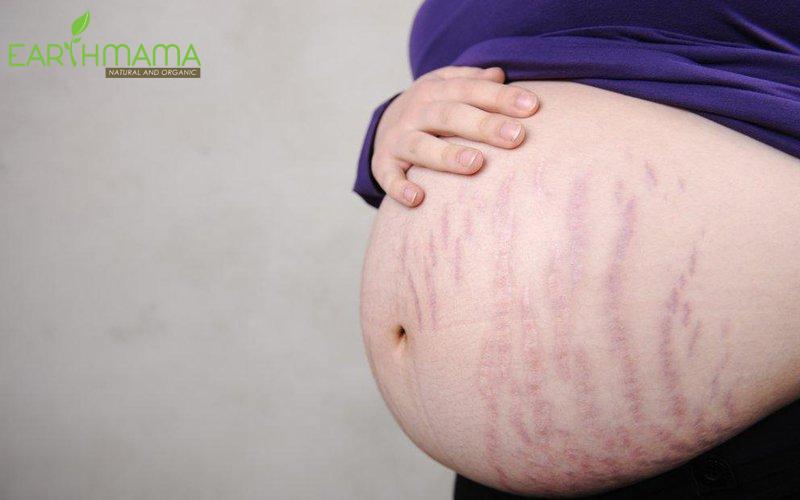 Kem chống rạn da organic Bio Mamma