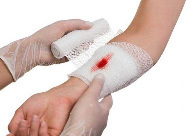 Hướng dẫn sơ cứu vết thương chảy máu bằng cách đè ép và băng vết thương